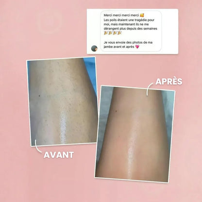 ÉpilLux© | Épilation Définitive à la Lumière Pulsée IPL
